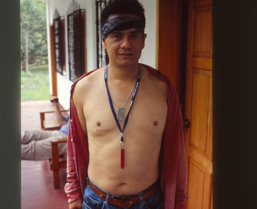 Sergios ar fra operation for svampesporer i lungerne under ekspeditionen 2001 .jpg